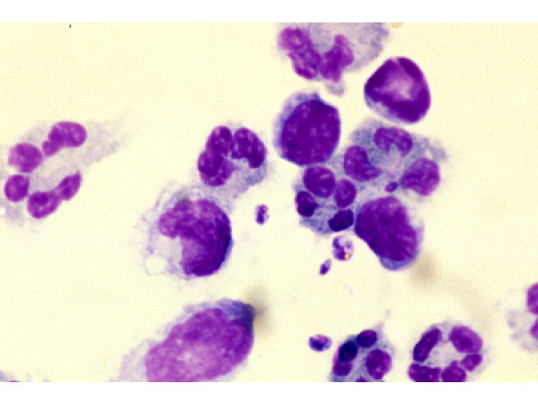 Cryptococcus neoformans Wrights stain
